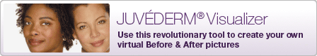 JuvedermÂ® Visualizer Create Your Own Before & After Pictures